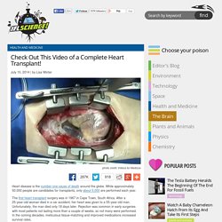 Check Out This Video of a Complete Heart Transplant!