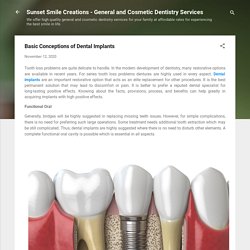 Basic Conceptions of Dental Implants