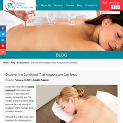 Discover the Conditions That Acupuncture Can Treat
