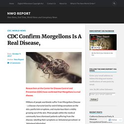 CDC Confirm Morgellons Is A Real Disease, – Nwo Report