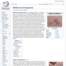 Molluscum contagiosum