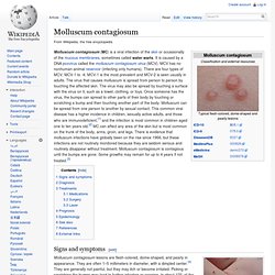 Diabetes virus treatment medicine