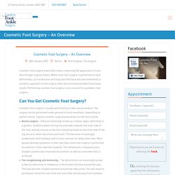Cosmetic Foot Surgery – An Overview
