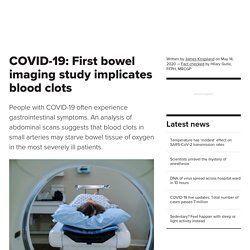 COVID-19: First bowel imaging study implicates blood clots