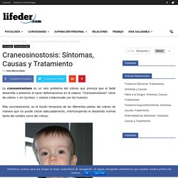 Craneosinostosis: Síntomas, Causas y Tratamiento - Lifeder