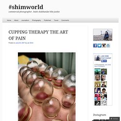 CUPPING THERAPY THE ART OF PAIN « SHIMWORLD