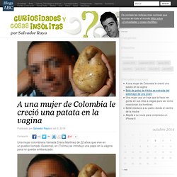 A una mujer de Colombia le creció una patata en la vagina