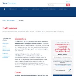 Daltonisme - Causes, Symptômes, Traitement, Diagnostic - canoe.ca