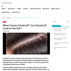 What Causes Dandruff ? Can Dandruff Lead to Hairfall ? - Vigourfact