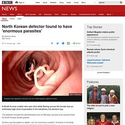North Korean defector found to have 'enormous parasites'