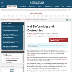 Nail Deformities and Dystrophies - Dermatologic Disorders