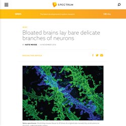 Bloated brains lay bare delicate branches of neurons