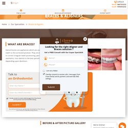 Teeth Braces Cost, Procedure, Types
