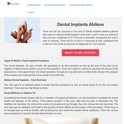 Dental Implants Abilene TX