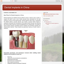 Dental Implants in China: Best Place for Dental Implants in China