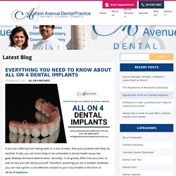 All on 4 Dental Implants Cost in Perth – All About All on 4 or 6 Implants