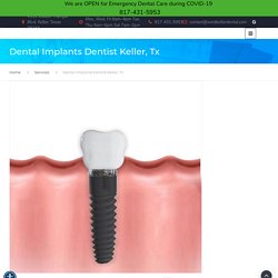 Best Dental Implants Dentist in Keller, Tx