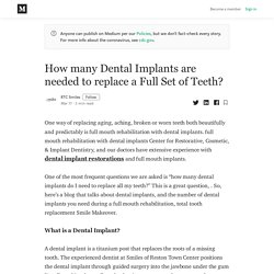 How many Dental Implants are needed to replace a Full Set of Teeth?
