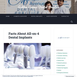 Facts About All-on-4 Dental Implants