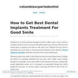How to Get Best Dental Implants Treatment For Good Smile