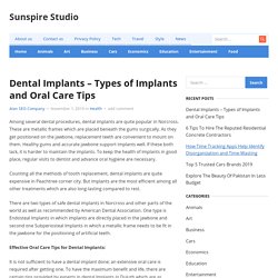 Dental Implants – Types of Implants and Oral Care Tips