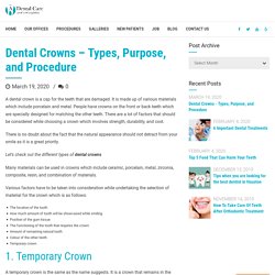 Dental Crowns - Types, Purpose, and Procedure - A Dental Care
