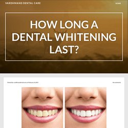 How long a dental whitening last? – Vardhmand Dental Care