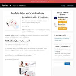 DermaRolling: Fastest Cure For Acne Scars Review