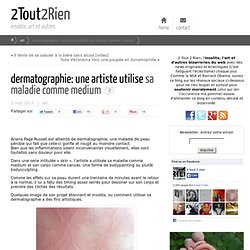 dermatographie: une artiste utilise sa maladie comme medium