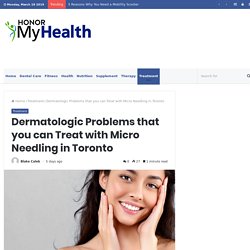 Dermatologic Problems that you can Treat with Micro Needling in Toronto – Honor My Health