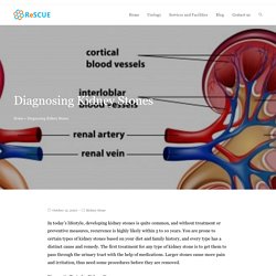 Diagnosing Kidney Stones - ReSCUE Urology Hospital Blog