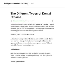 The Different Types of Dental Crowns