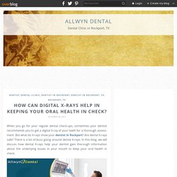 How Can Digital X-Rays Help in Keeping Your Oral Health in Check?