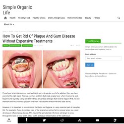 How To Get Rid Of Plaque And Gum Disease Without Expensive Treatments