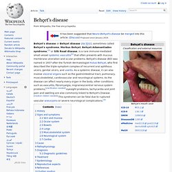 Behçet's disease