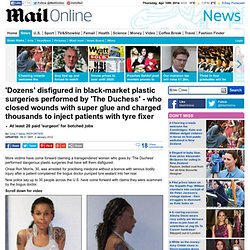 Dozens disfigured in black-market plastic surgeries by 'The Duchess' Oneal Ron Morris