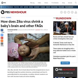 How does Zika virus shrink a baby's brain and other FAQs