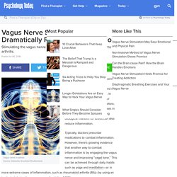 Vagus Nerve Stimulation Dramatically Reduces Inflammation