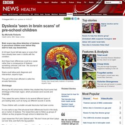 News - Dyslexia 'seen in brain scans' of pre-school children