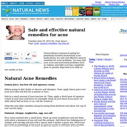Safe and effective natural remedies for acne