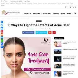 8 Ways to Fight the Effects of Acne Scar - Beauty Healthy Tips - Skin, Hair, Nails, Anti-Aging, and Cosmetic