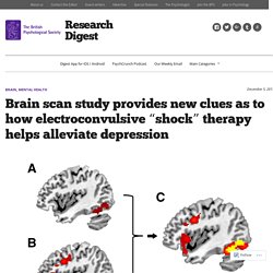 Brain scan study provides new clues as to how electroconvulsive “shock” therapy helps alleviate depression
