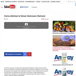 Como eliminar la Venas Varicosas (Varices) | Salud Viral