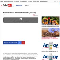 Como eliminar la Venas Varicosas (Varices)