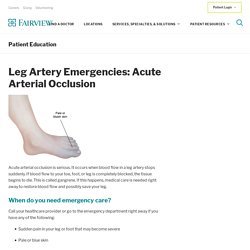 Leg Artery Emergencies: Acute Arterial Occlusion