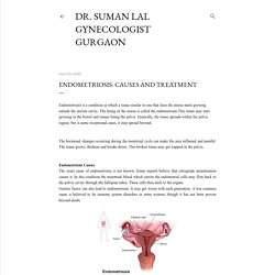 Endometriosis: Causes and Treatment