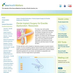 Penile Implant Surgery for Erectile Dysfunction: Resources