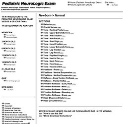 Pediatric Neurologic Examination Videos & Descriptions: Newborn > Normal