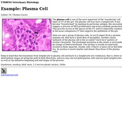 Example: Plasma Cell
