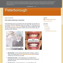 Eyelash Extensions Peterborough: Why teeth whitening is important